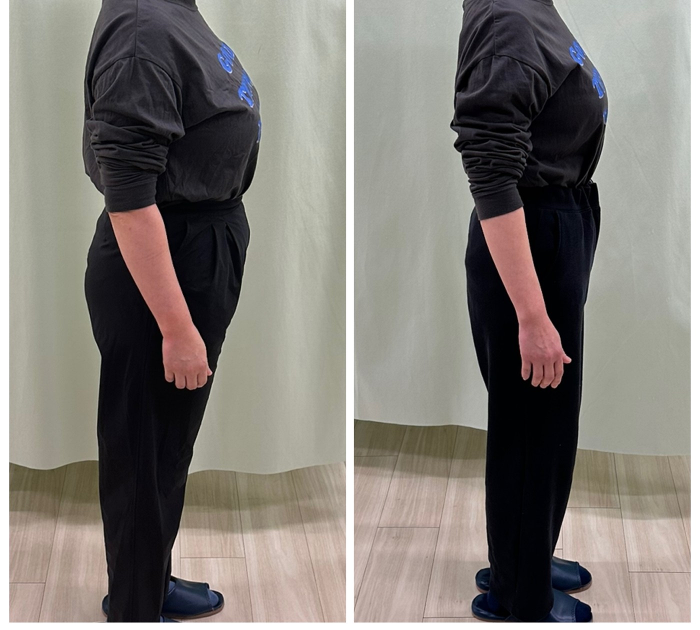 52歳女性のダイエット開始前と卒業時の横向き比較写真