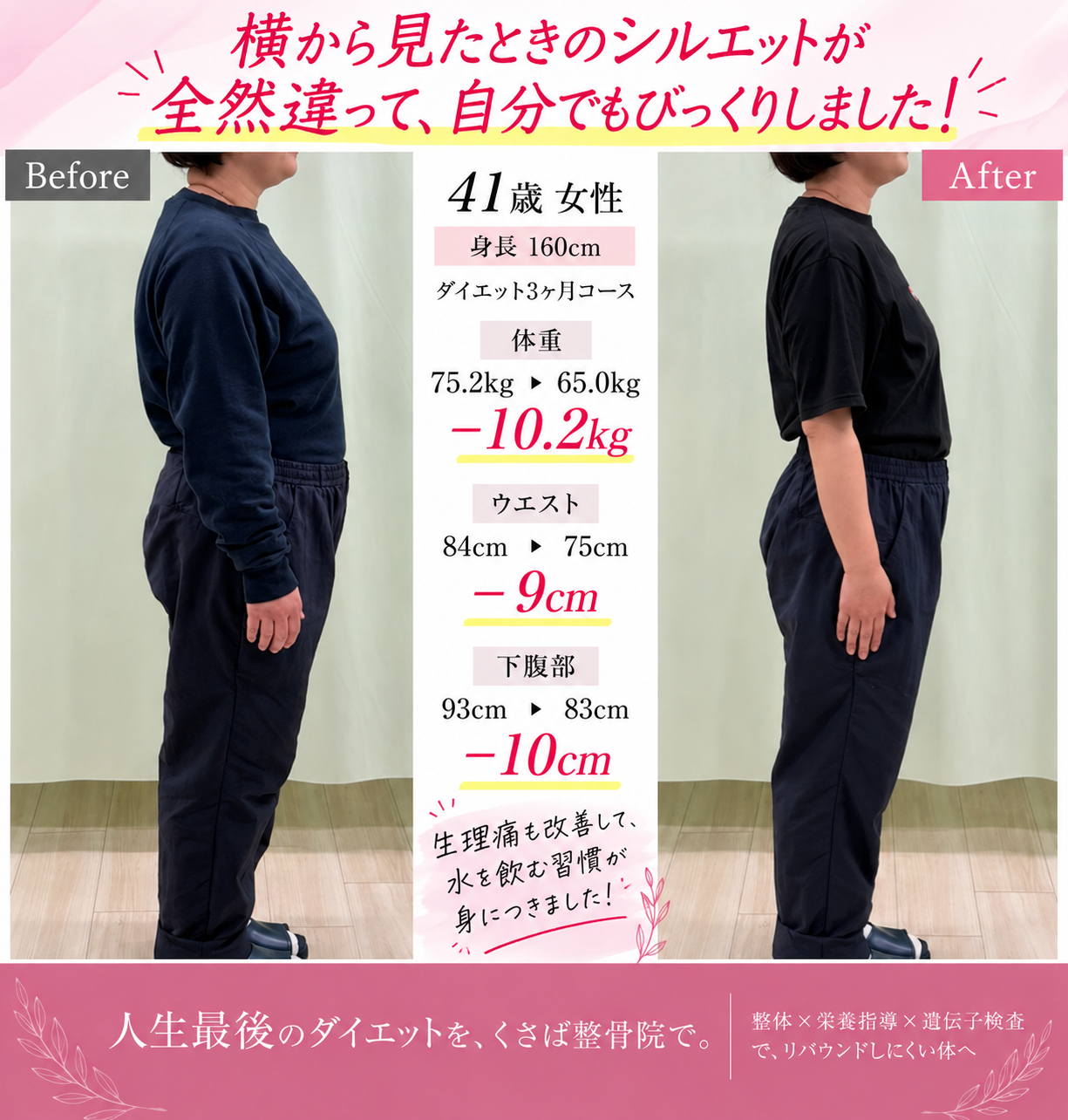 症例11・41歳女性の3ヶ月間のBefore／After